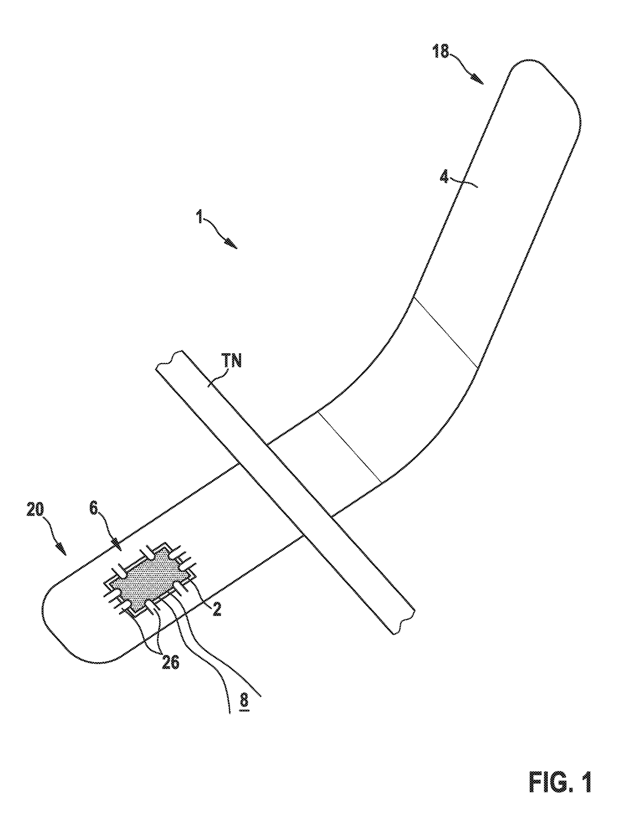 System, Method and Tool for Implanting Peripheral Nerve Electrode Cuff