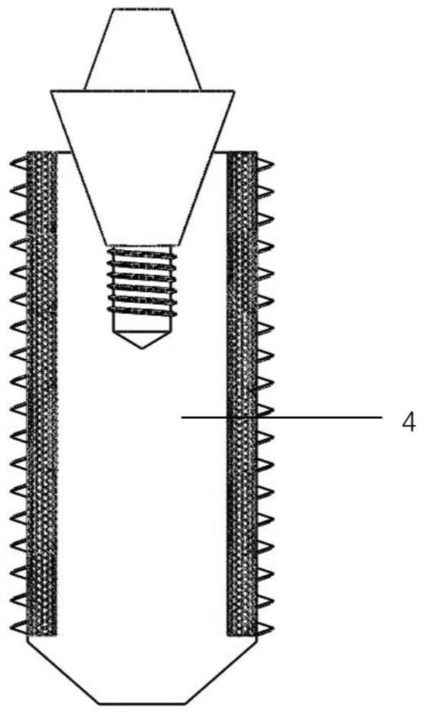 Improved porous implant loaded with Schwann cell-derived exosome