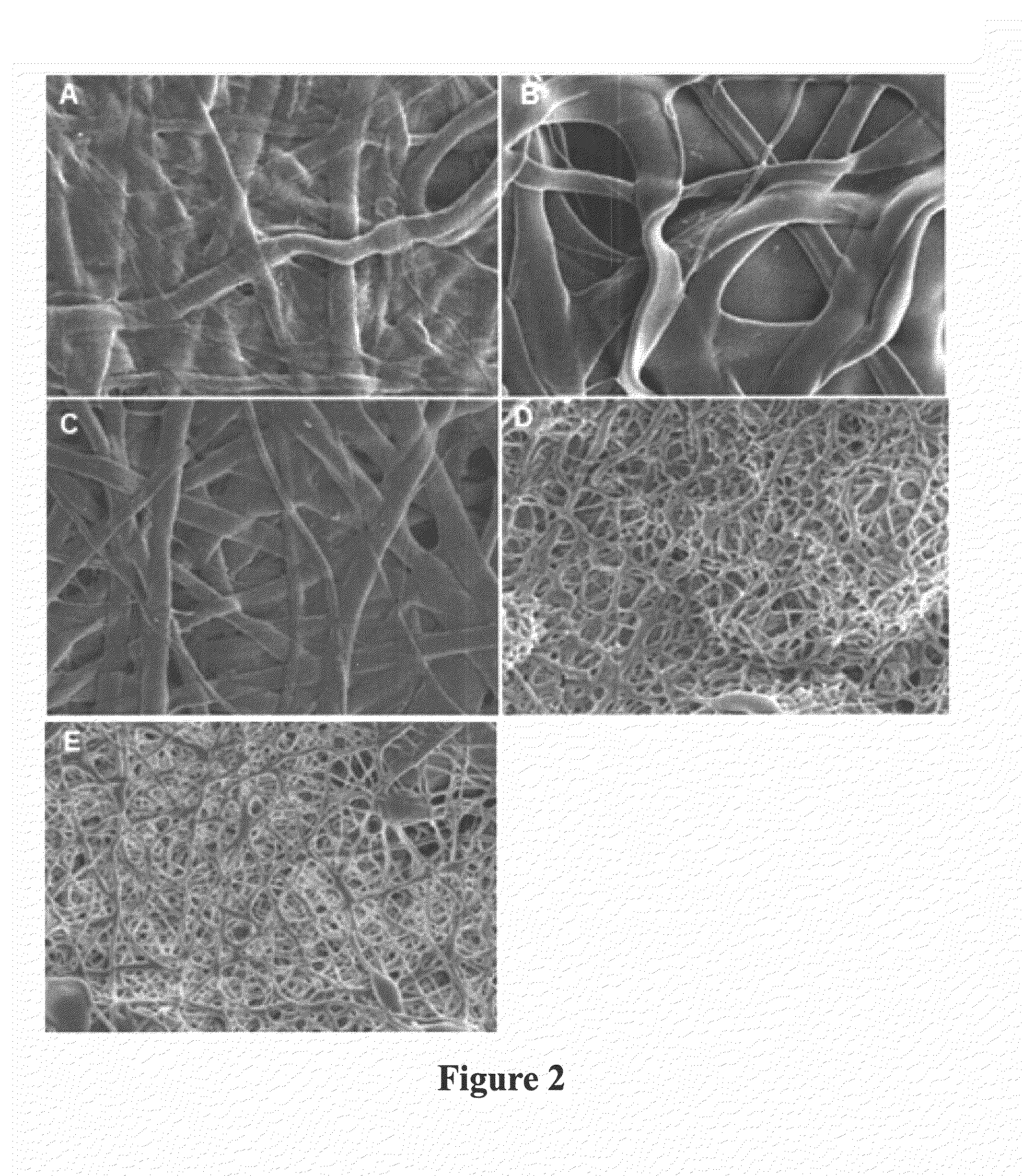 Novel nanofiber-based graft for heart valve replacement and methods of using the same