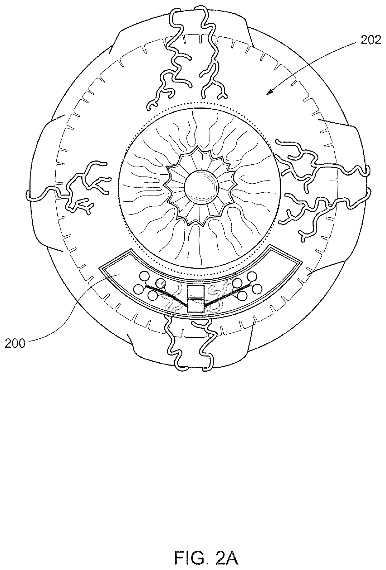 Eye mounted device for therapeutic agent release