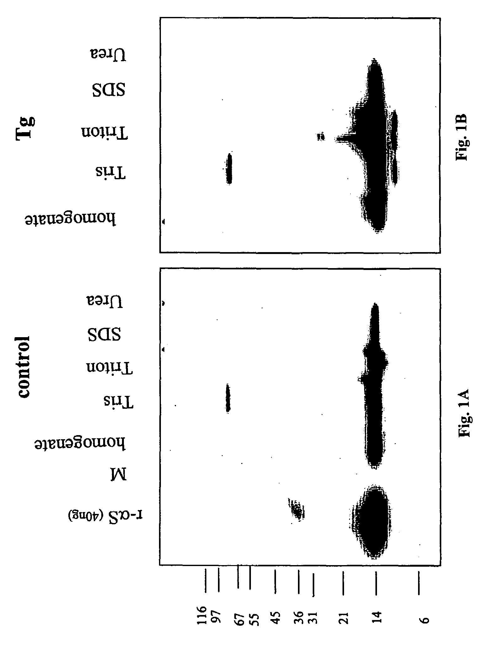 Truncated fragments of alpha-synuclein in Lewy body disease