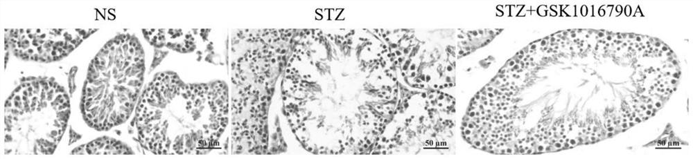 Application of TRPV4 agonist in preparation of medicine for treating and/or preventing male infertility