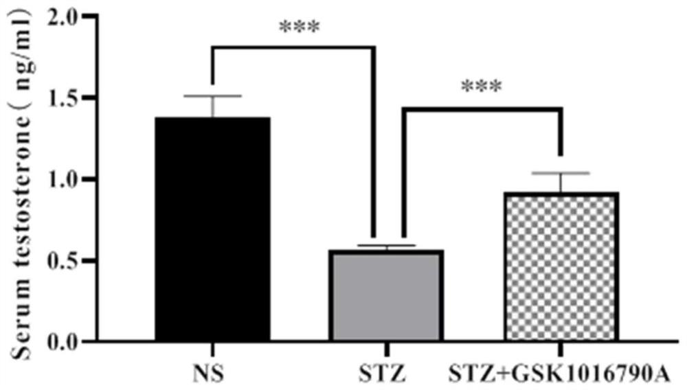 Application of TRPV4 agonist in preparation of medicine for treating and/or preventing male infertility