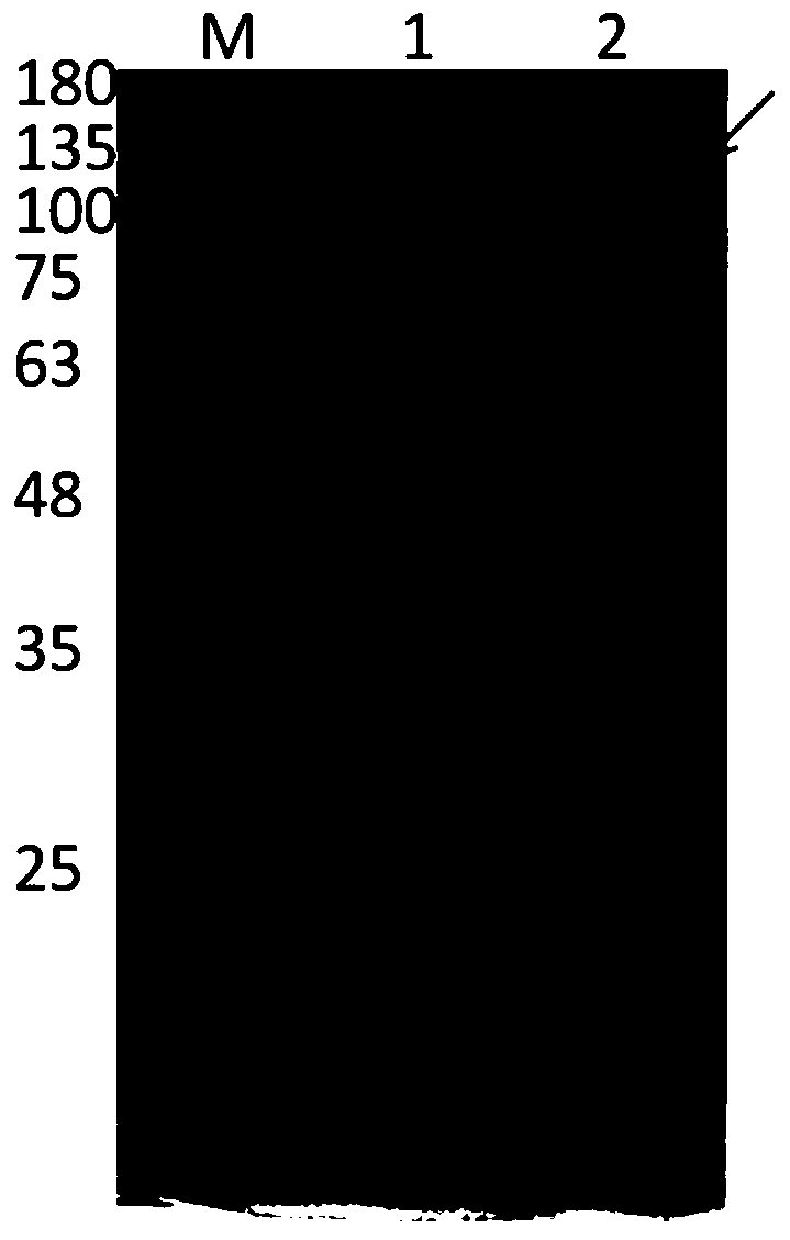 Recombinant human collagen and application thereof