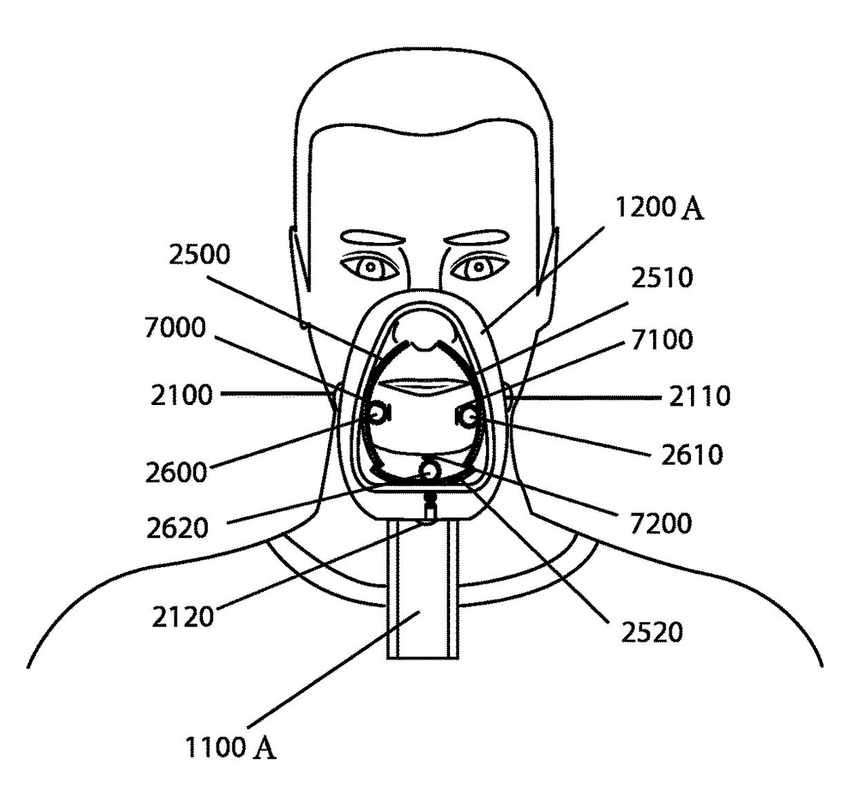 Facial hair shaver with built-in facial hair pattern guides