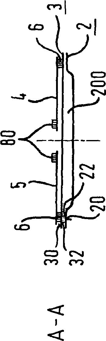 Absorbability article, belt structure, method for manufacturing belt structure and absorbability article