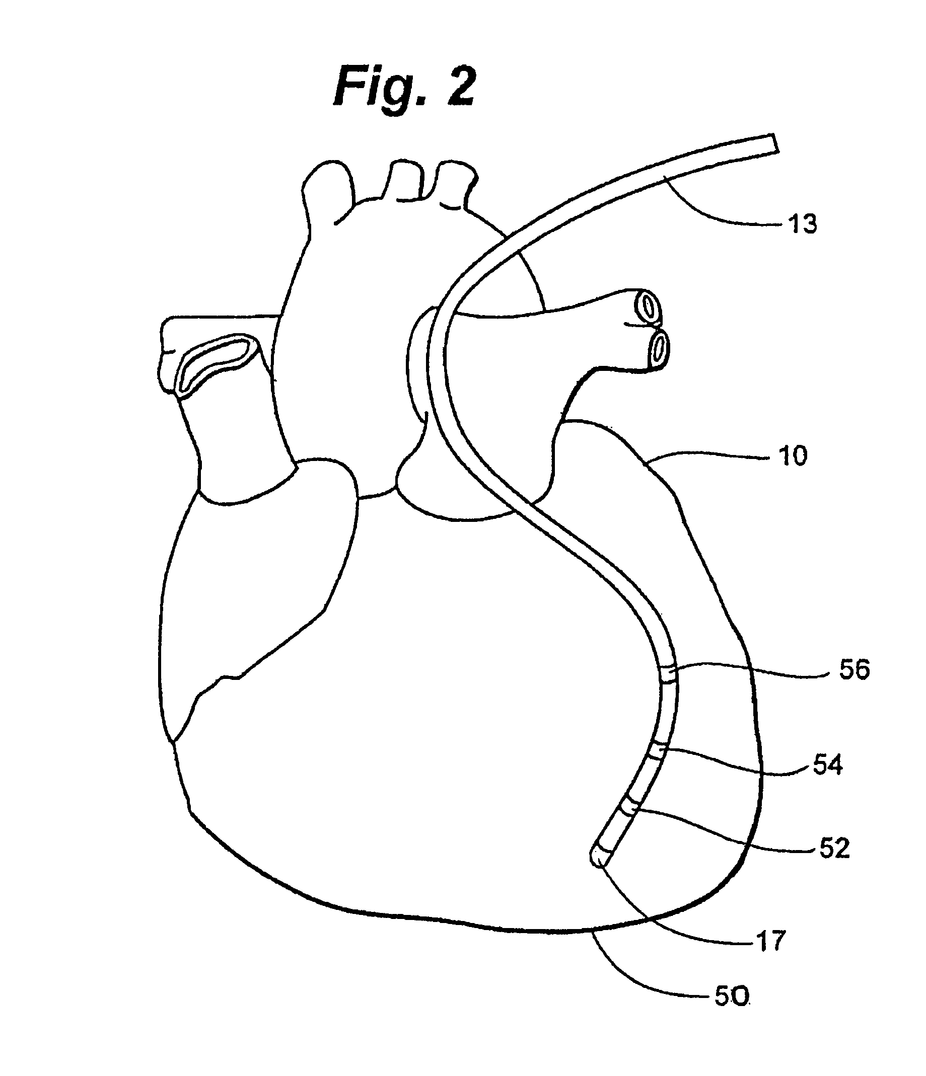 System and method for correction of inhomogeneous fields