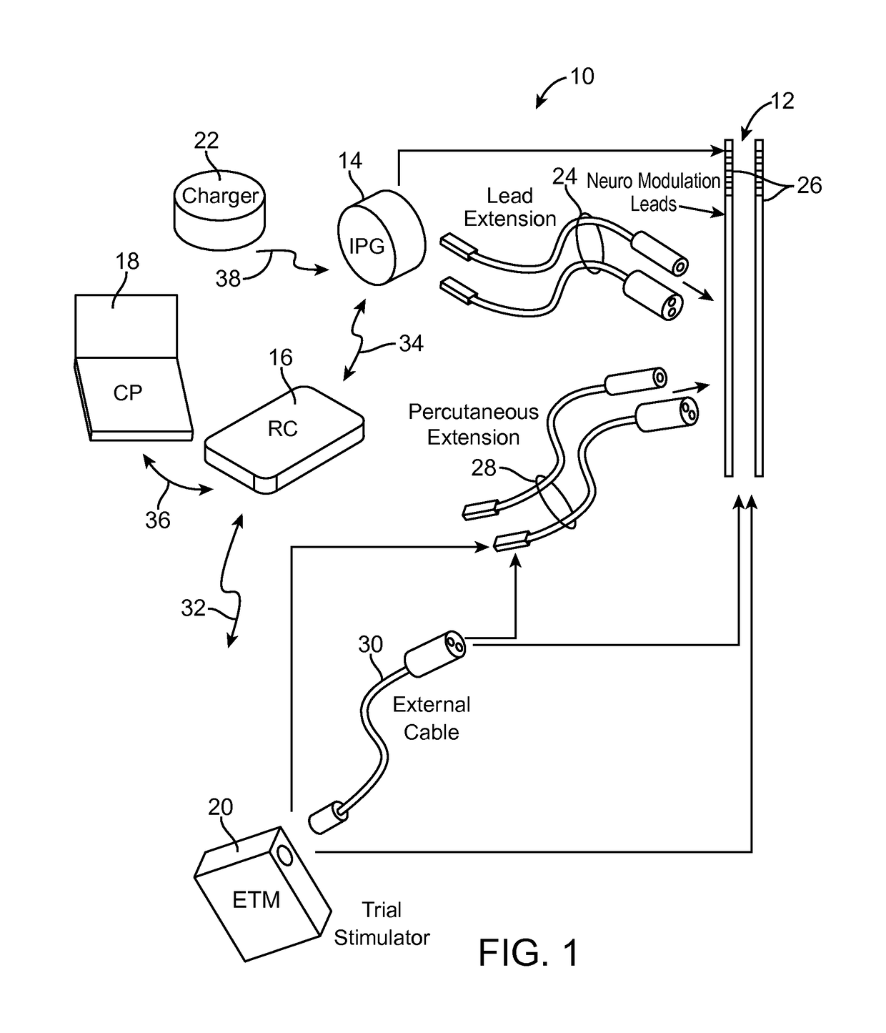 Systems and method for automatically detecting an MRI environment for patient implanted with medical device