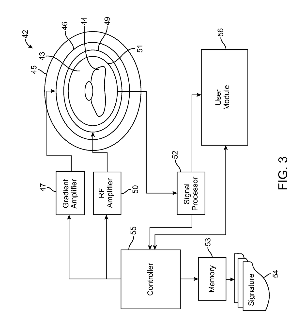 Systems and method for automatically detecting an MRI environment for patient implanted with medical device