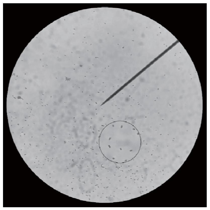 Bacillus catonella strain DM4-2 with inhibiting effect on plant scab as well as fungicide and application thereof