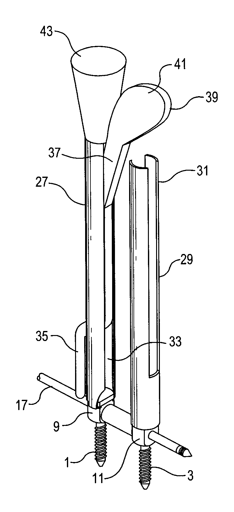 Percutaneous system for dynamic spinal stabilization