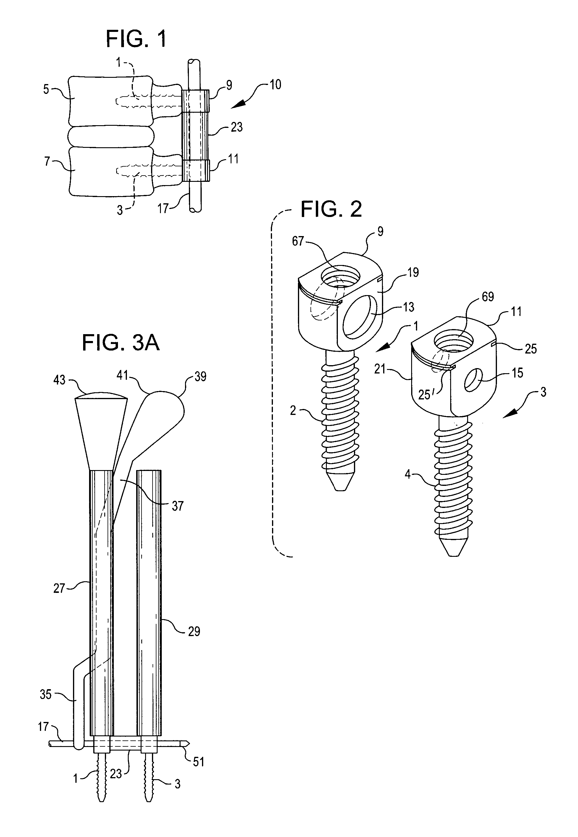 Percutaneous system for dynamic spinal stabilization