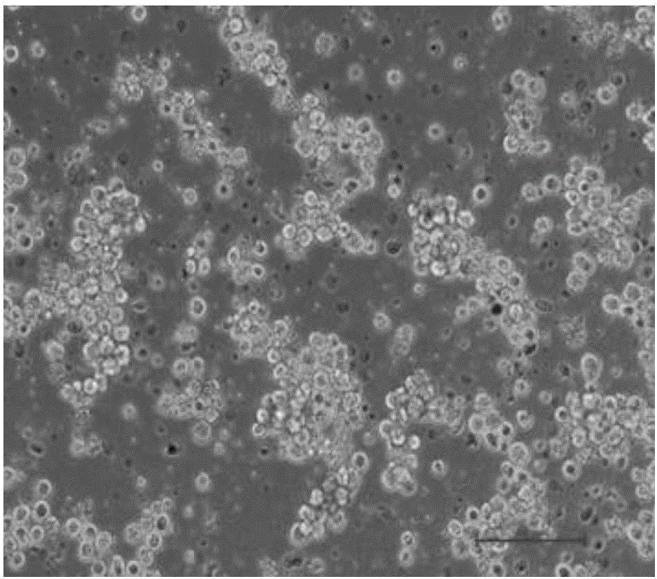 Method for culturing and inducing tilapia mossambica peritoneal preadipocytes and culture medium thereof