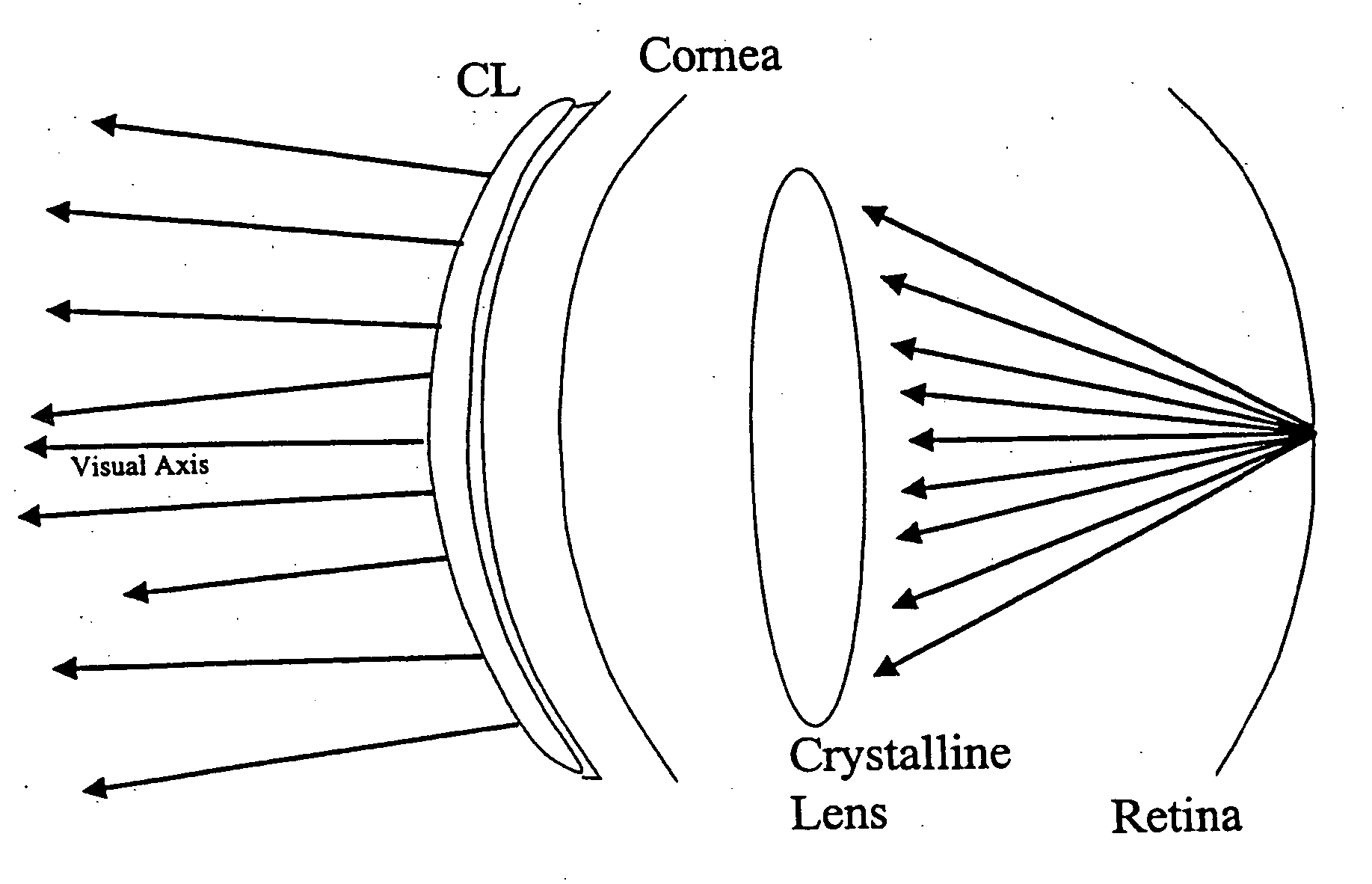 Hybrid contact lens system and method