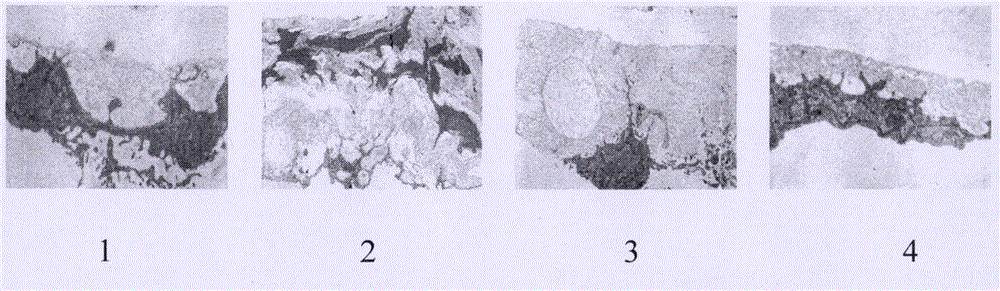 Pharmaceutical composition for preventing atherosclerosis and application thereof