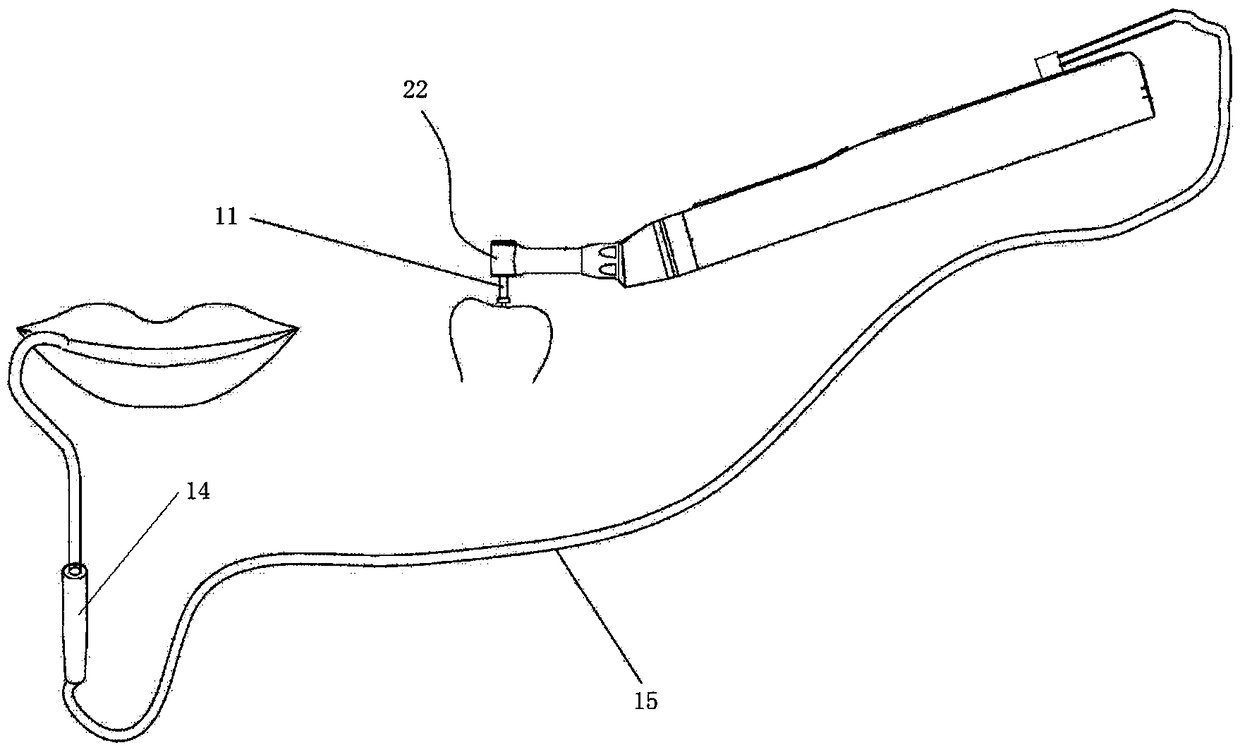 Motor driven intelligent control device for root canal apex locator and control method thereof