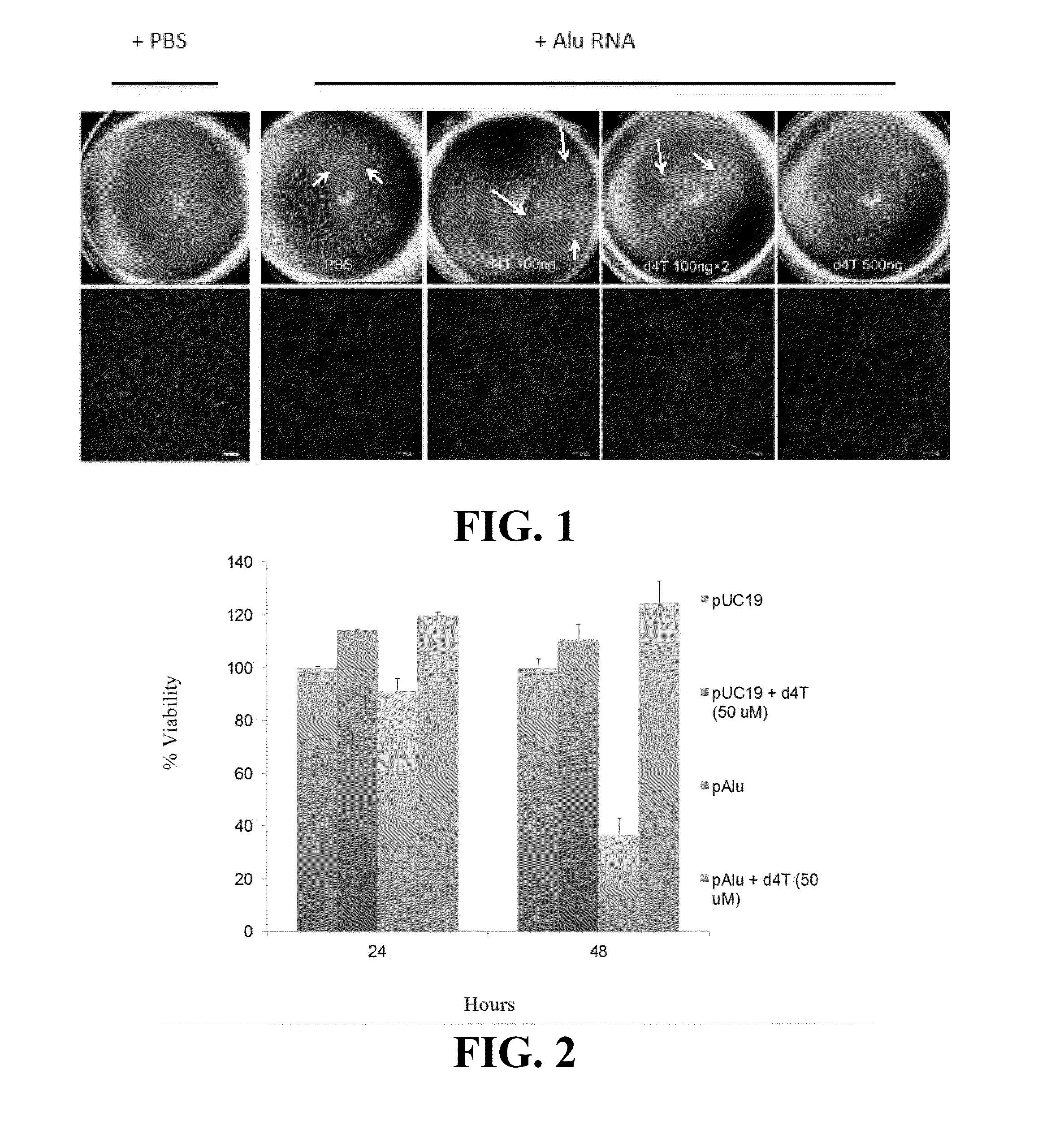 Compositions and methods for treating retinal degradation