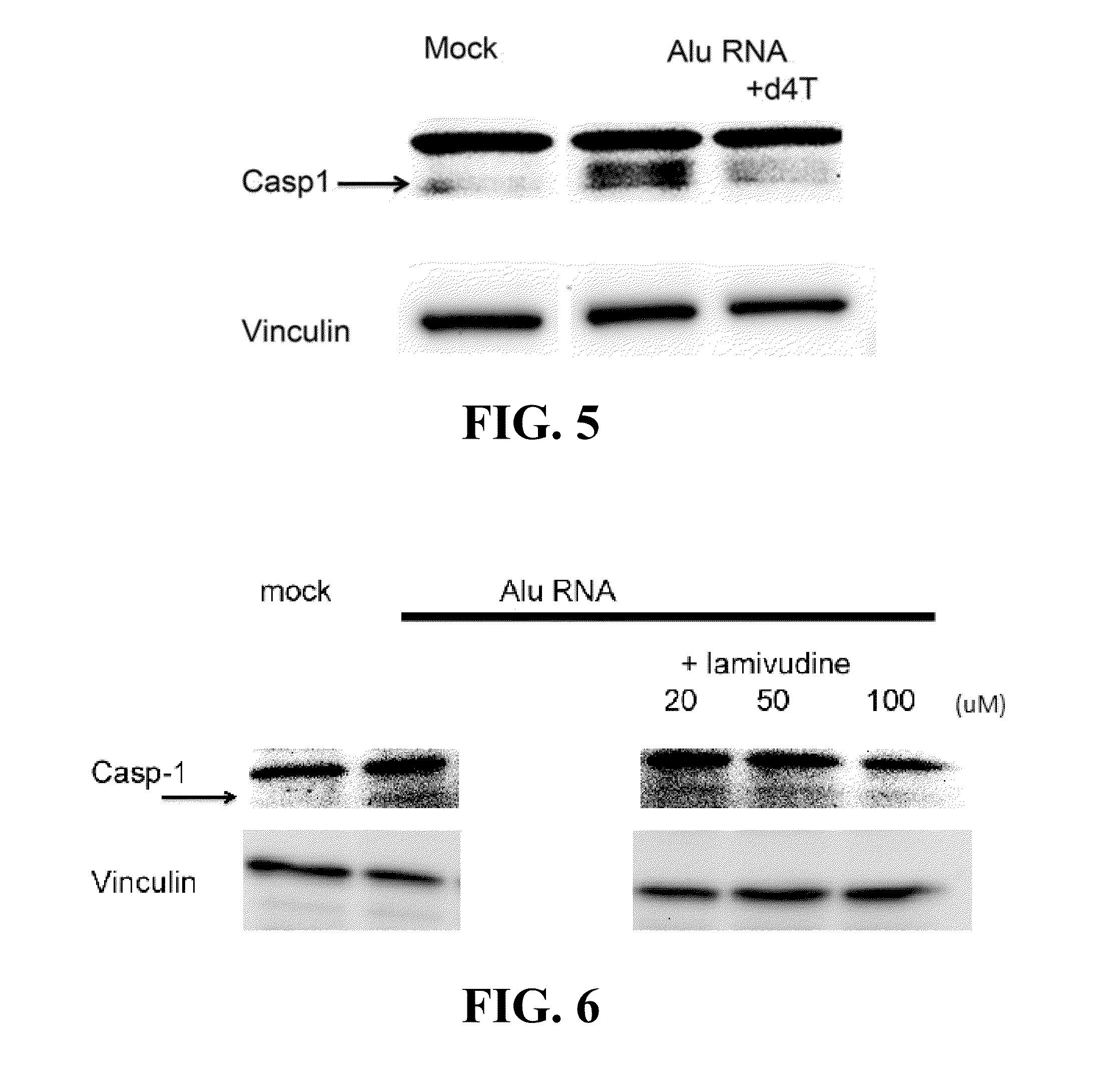 Compositions and methods for treating retinal degradation