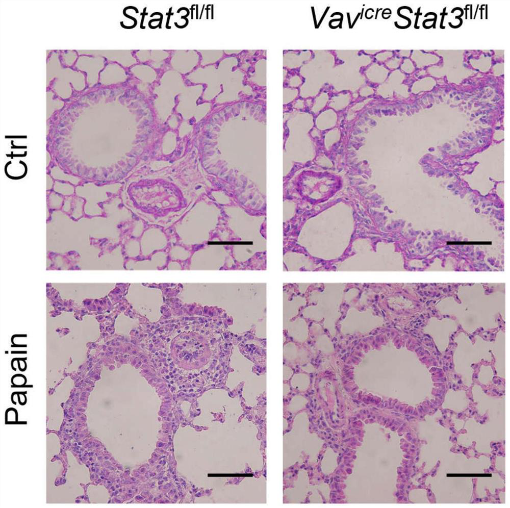 New application of HSP90 inhibitor to inhibition of STAT3 mitochondrial transport and treatment of asthma