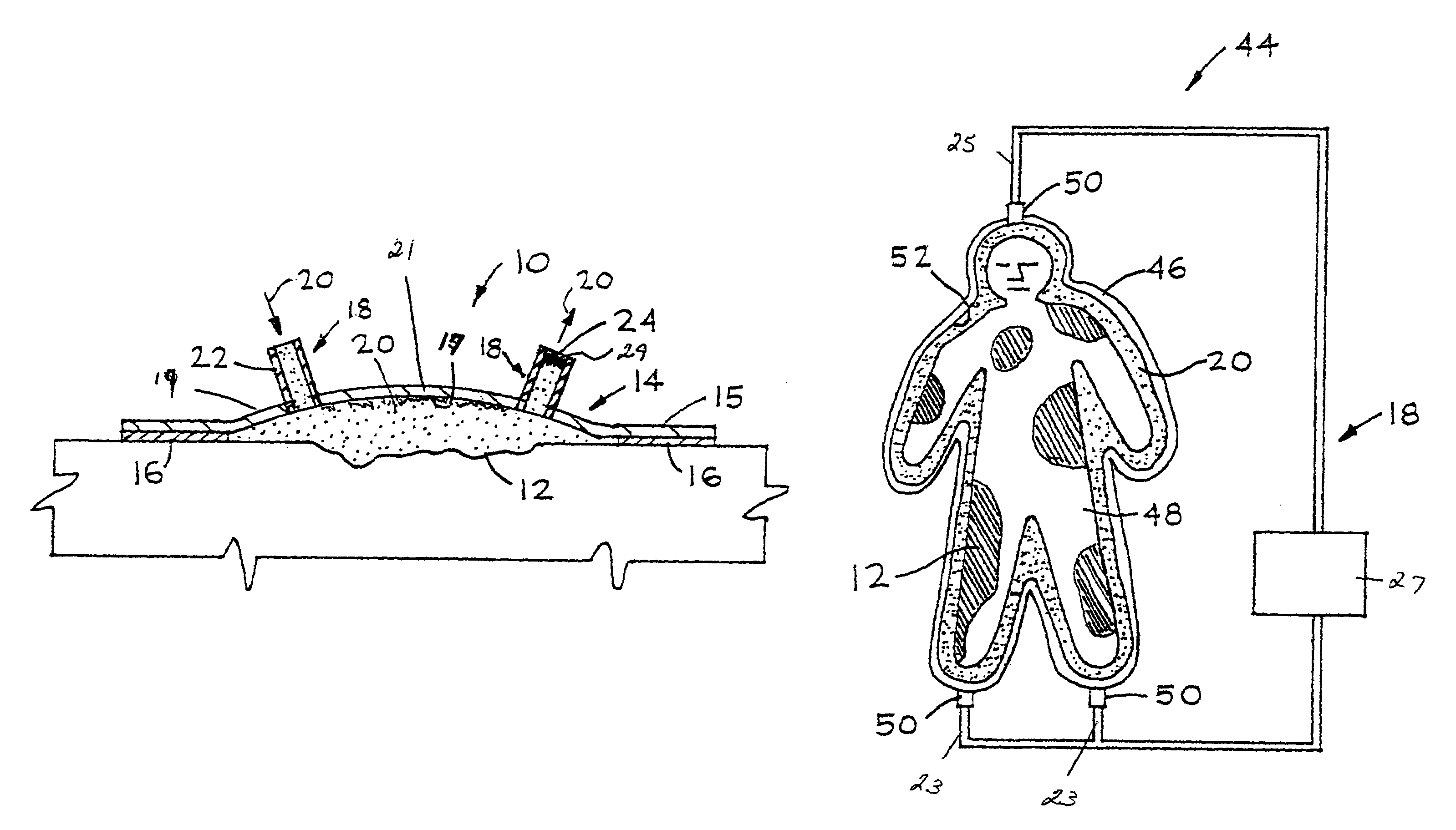 Wound alternative treatment system