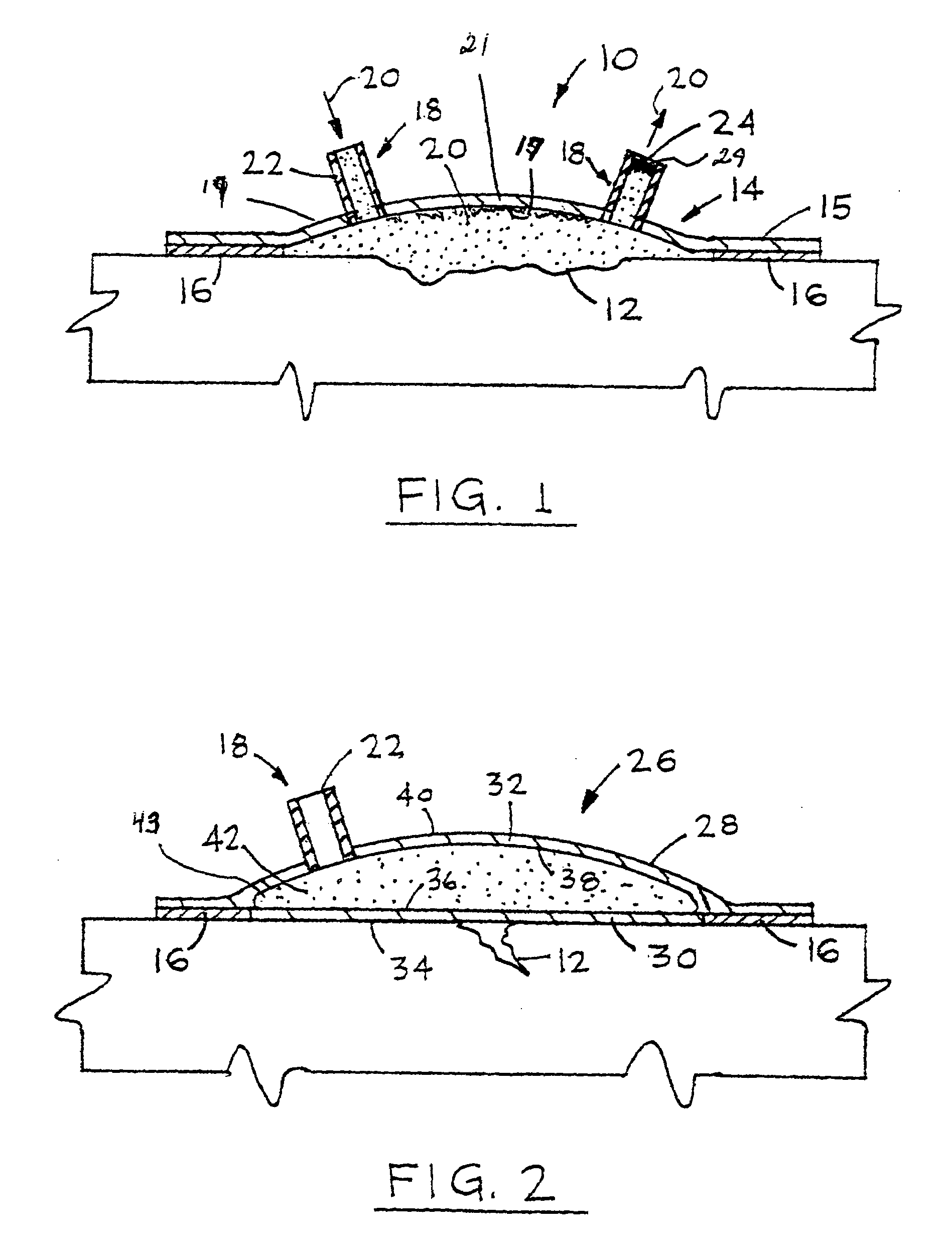 Wound alternative treatment system