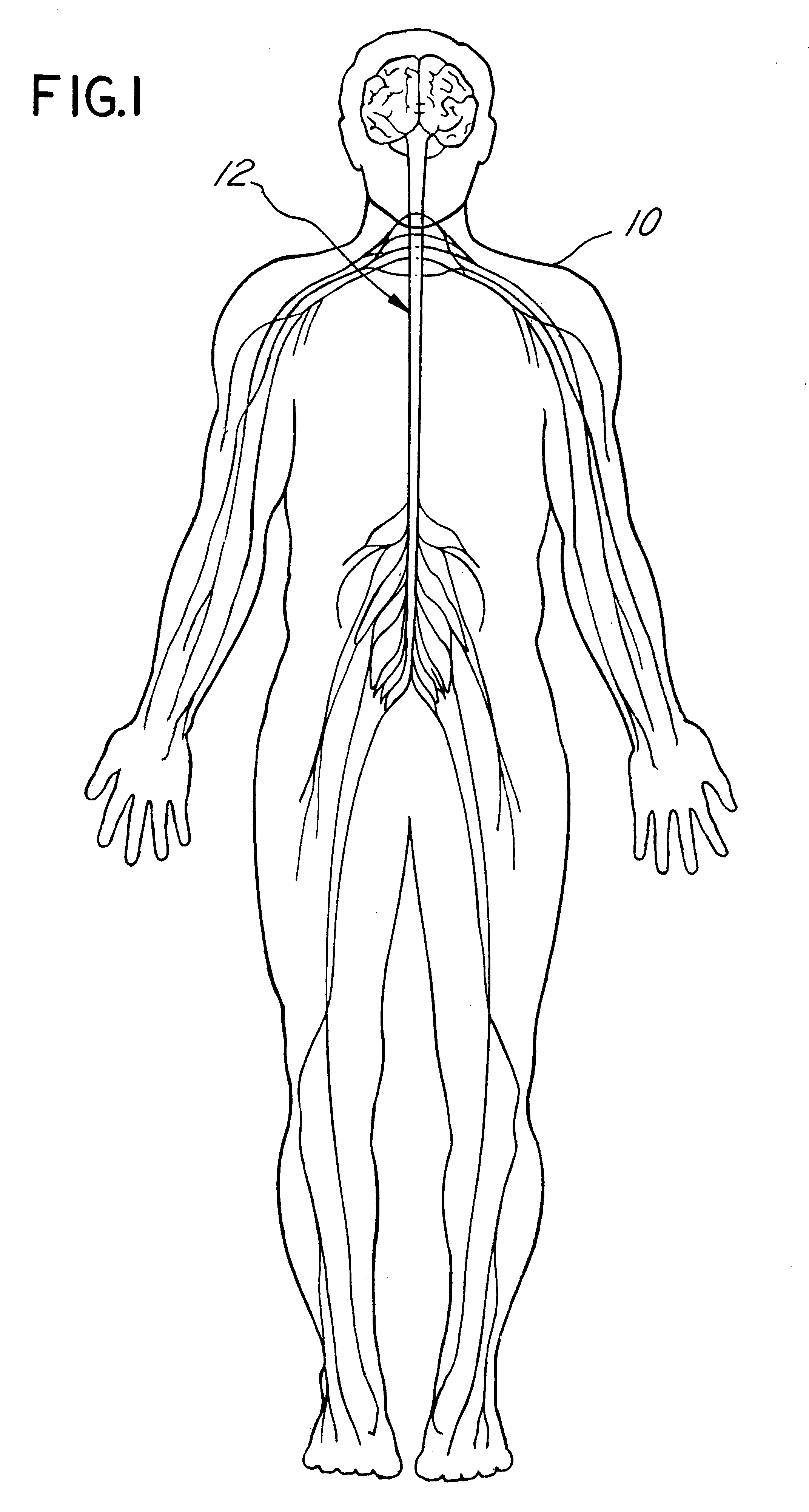 Apparatus and method for percutaneous implant of a paddle style lead