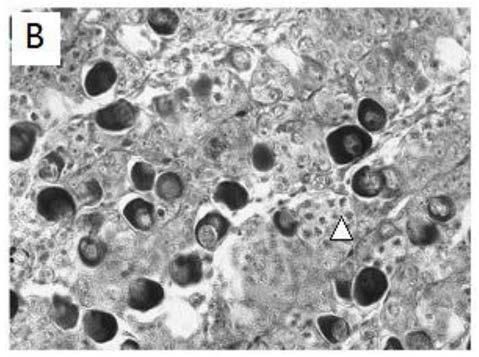 Screening method, kit and application of sex reversal genetic control loci in half-smooth tongue sole