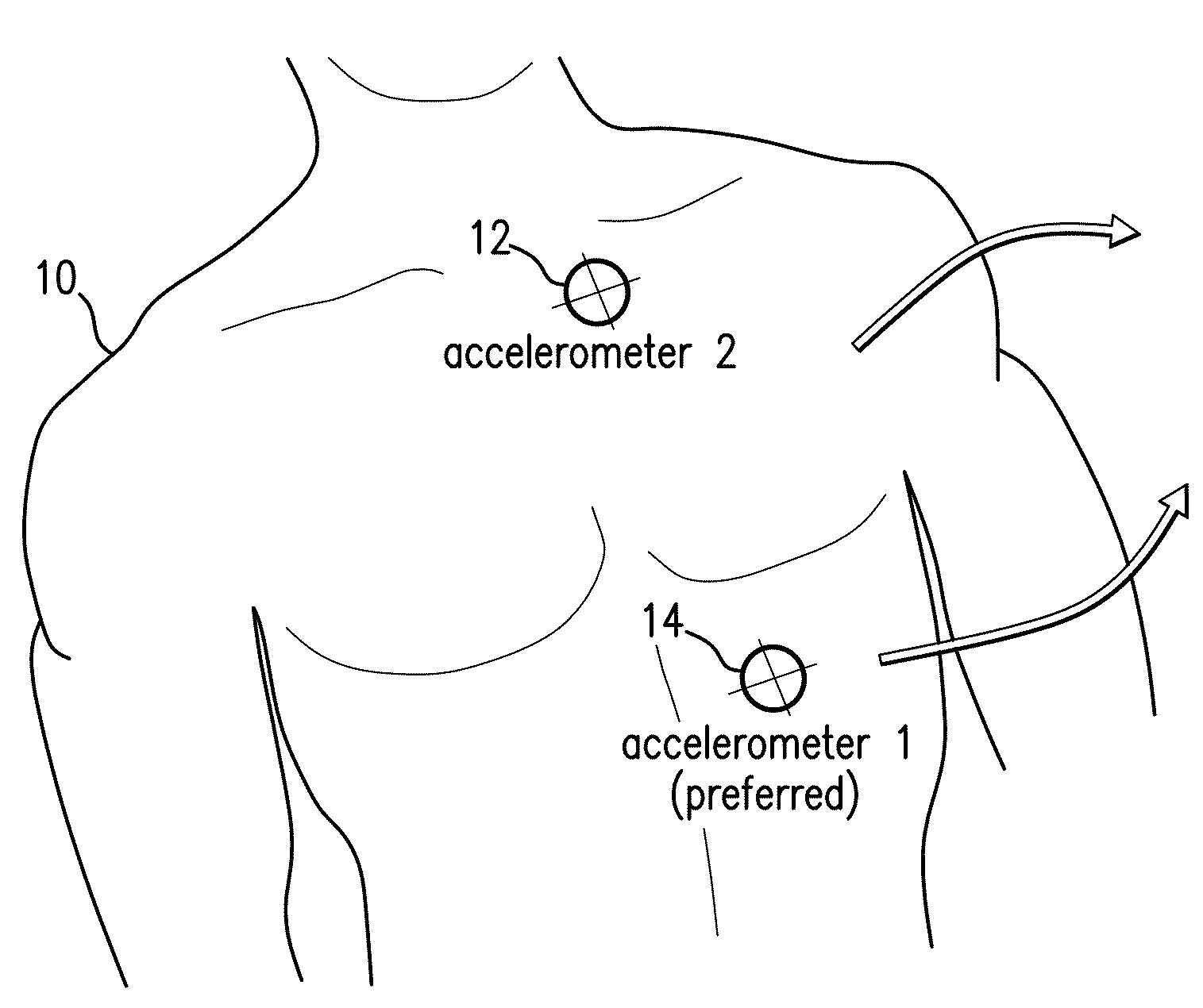 Body-worn monitor for measuring respiration rate