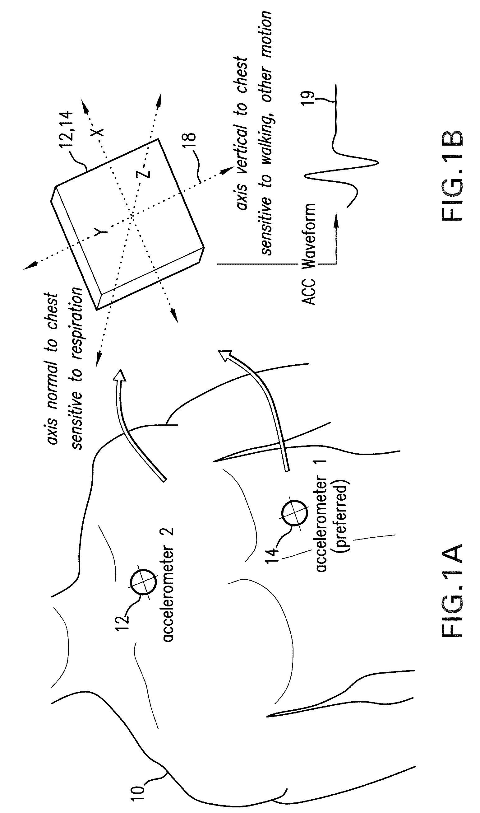 Body-worn monitor for measuring respiration rate