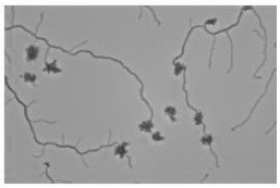 A kind of preservation method of actinomycetes teikao