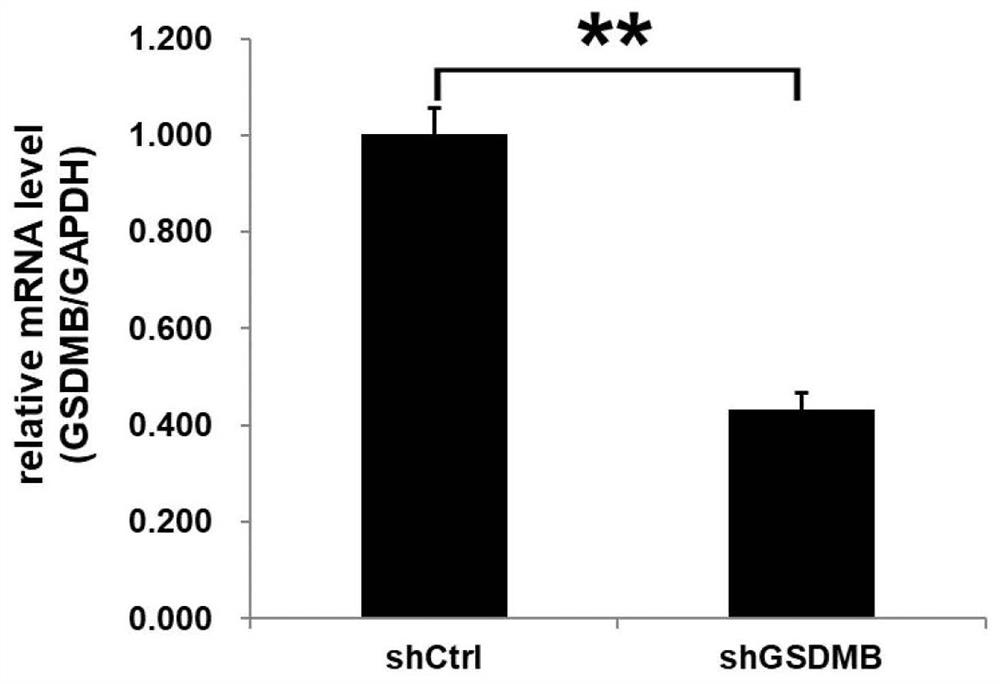 Use of human gsdmb gene and related products