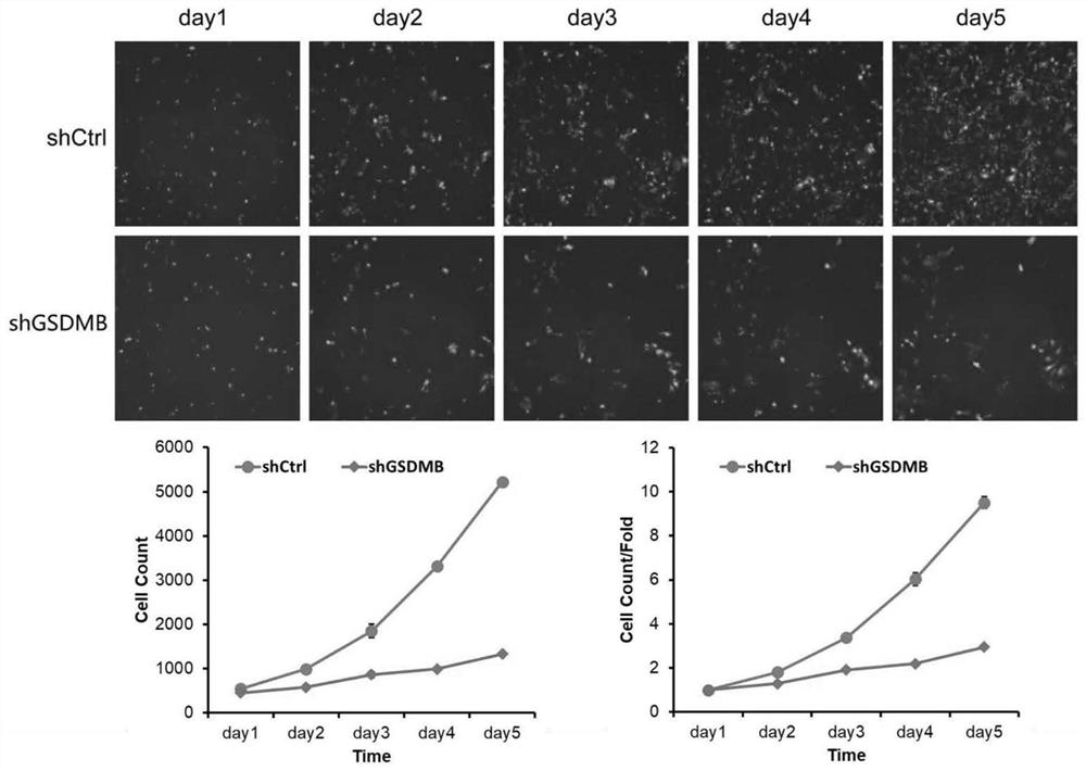 Use of human gsdmb gene and related products