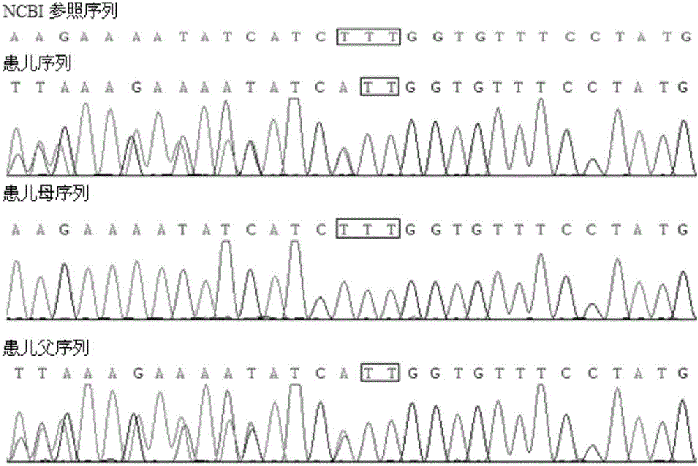 CFTR (Cystic Fibrosis Transmembrane Conductance Regulator) gene deletion mutation form of cystic fibrosis patients and application of CFTR gene deletion mutation form