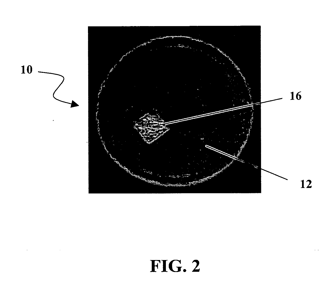 Particulate filter and method of use