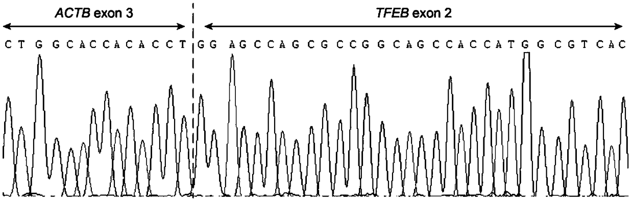 Probe assembly for diagnosing ACTB-TFEB translocation renal carcinoma and application thereof