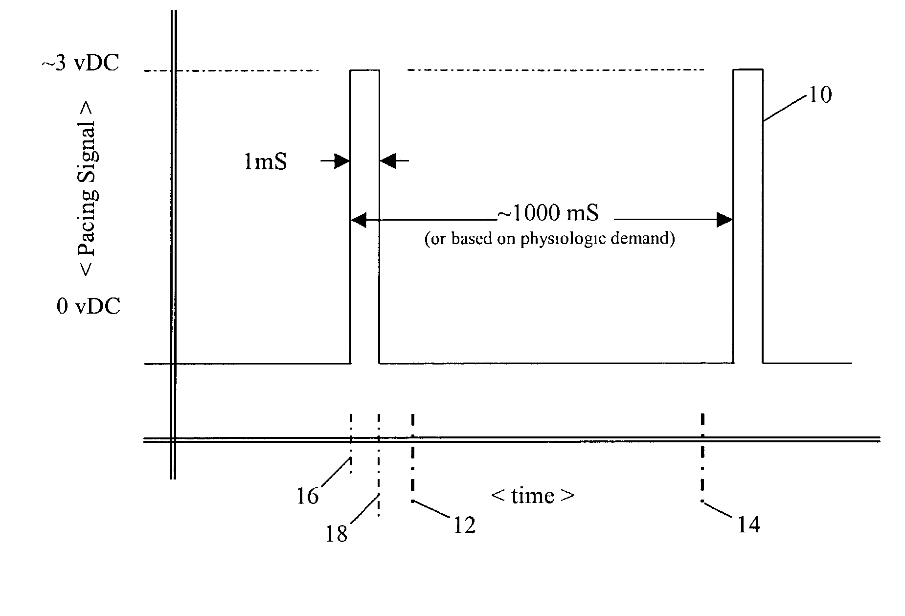 Pulsewidth electrical stimulation