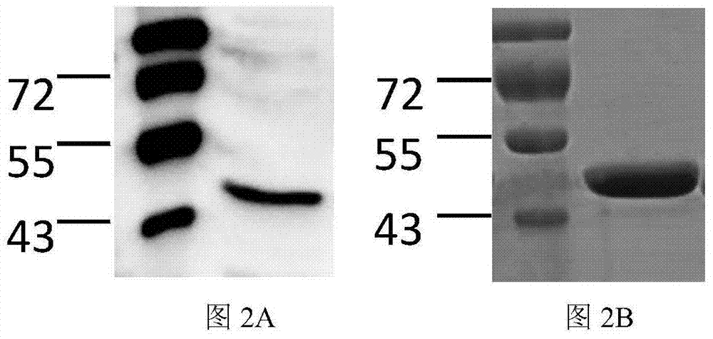 Erysipelothrix rhusiopathiae antigen protein sbp and application