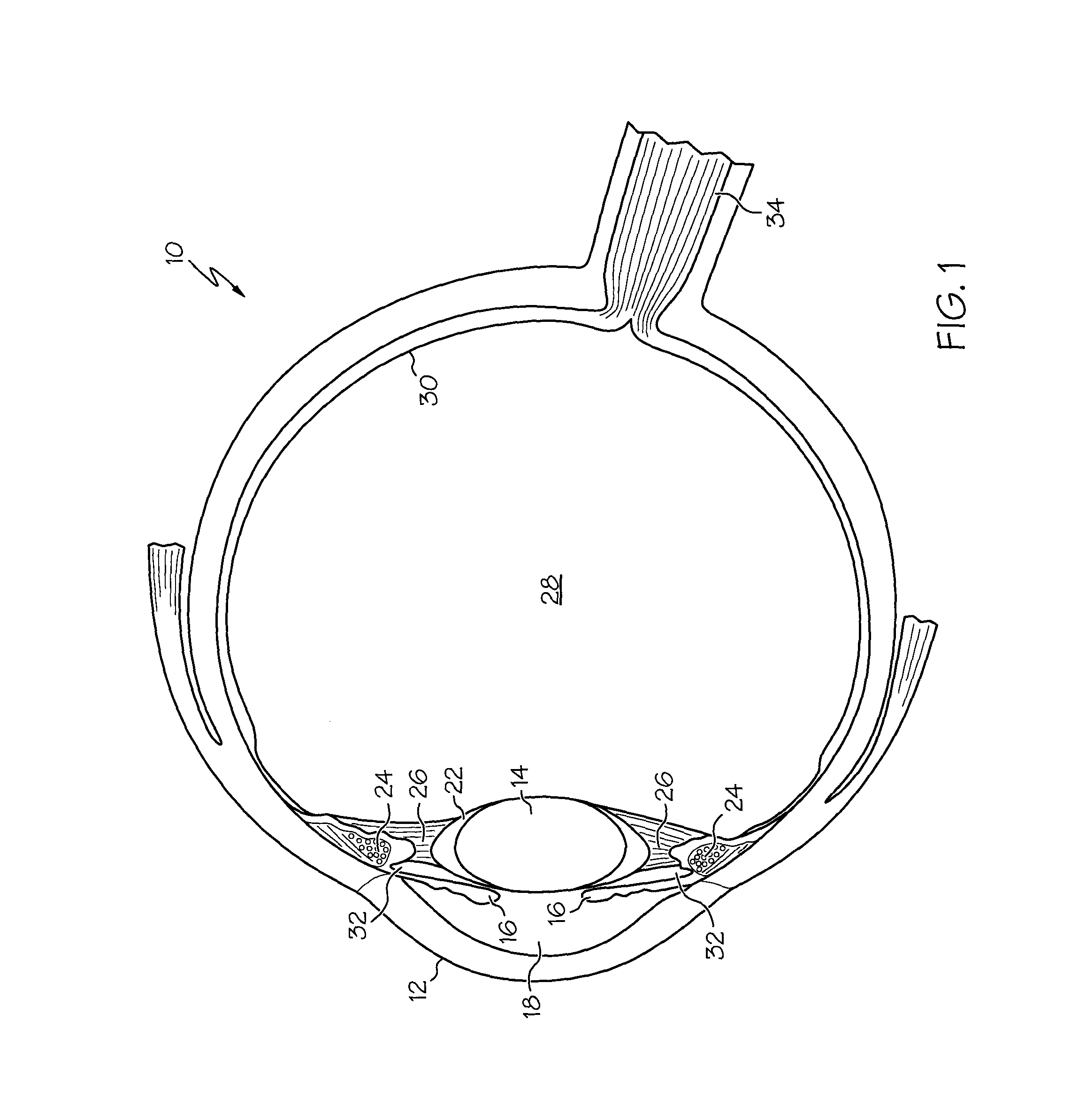 Accommodating intra-ocular lens system