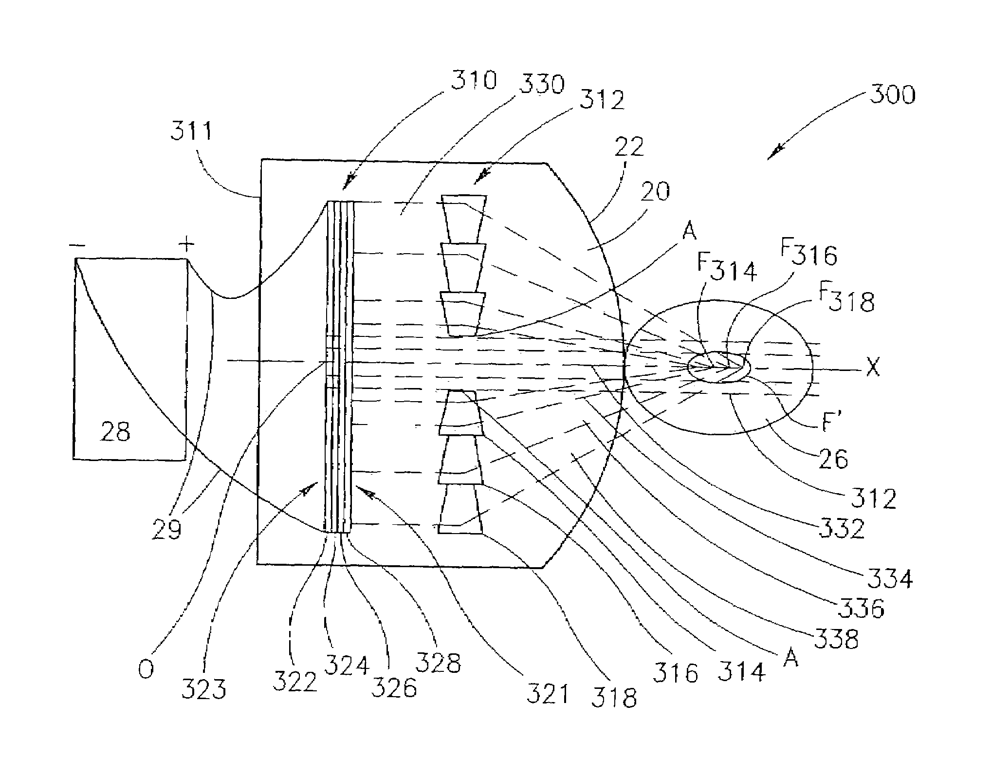 Pressure-pulse therapy apparatus