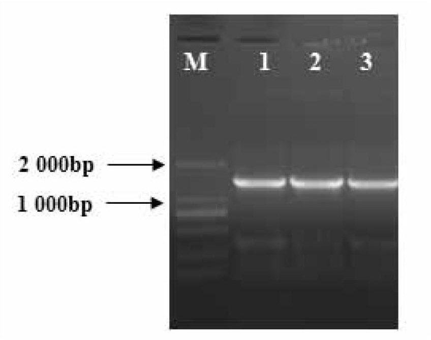 Construction method of genetic engineering strains for improving quantity of soybean nodules