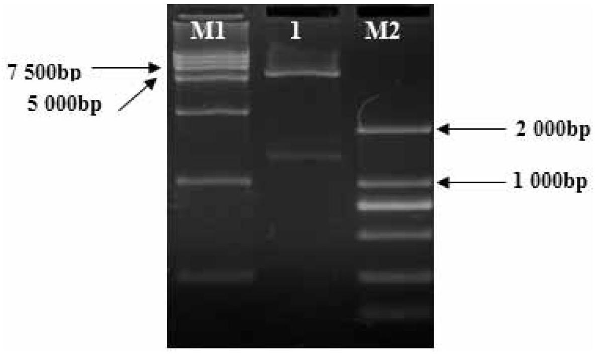 Construction method of genetic engineering strains for improving quantity of soybean nodules