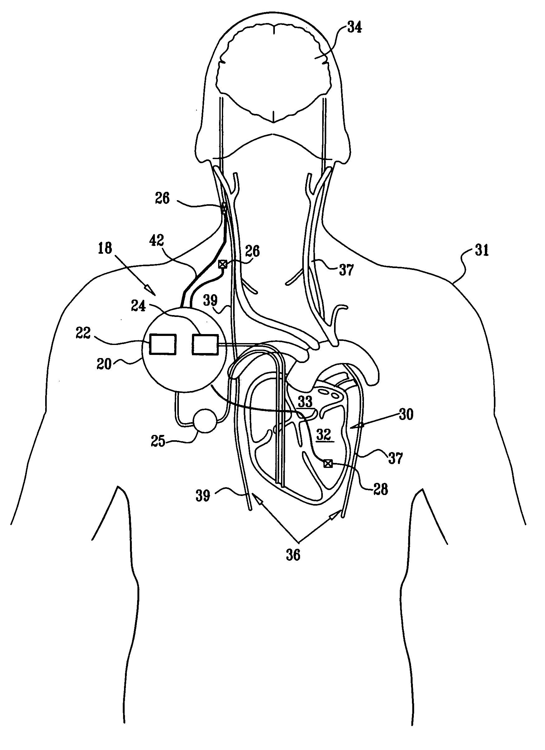 Treatment for disorders by parasympathetic stimulation