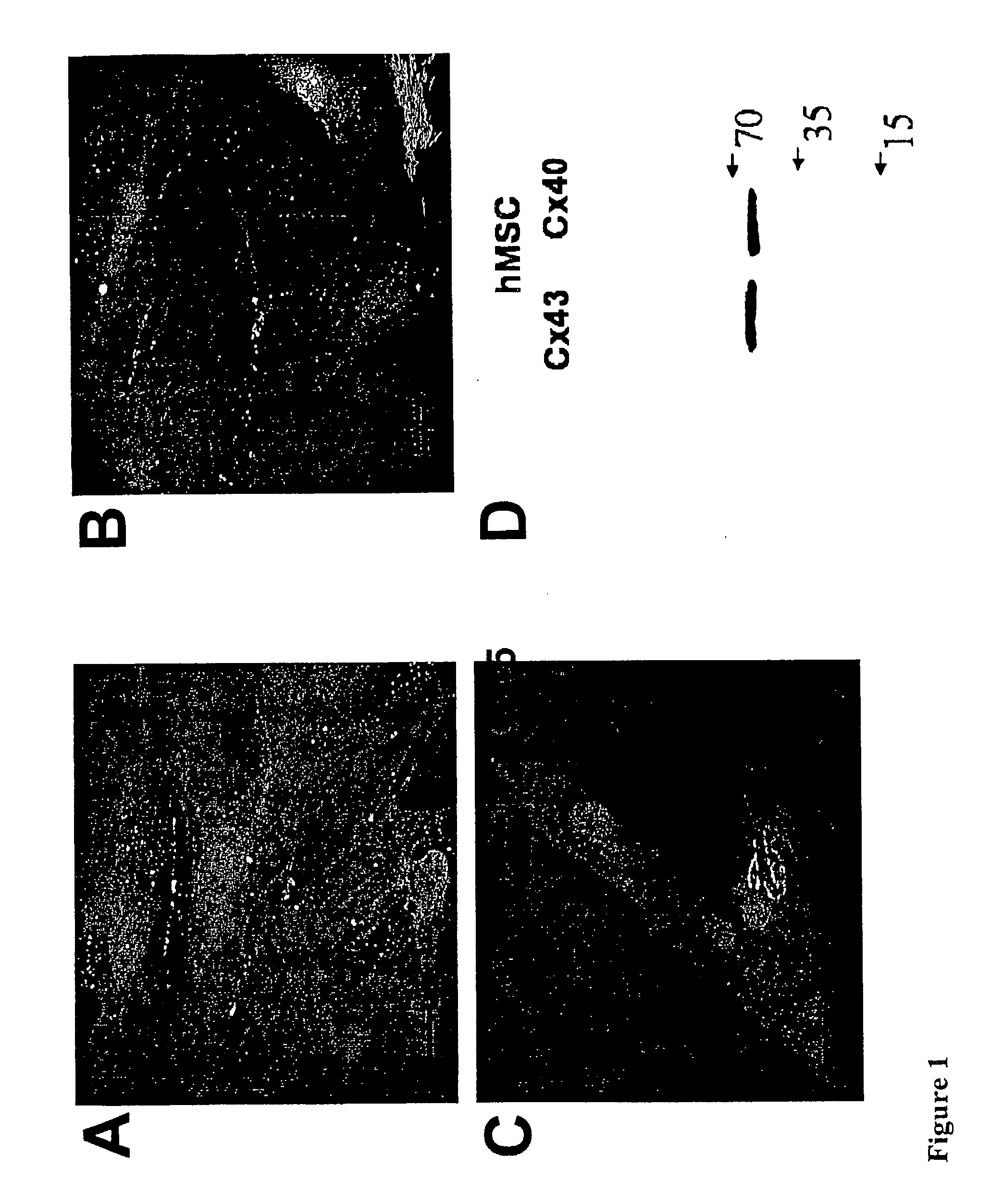 Creation of a Biological Atrioventricular Bypass to Compensate for Atrioventricular Block