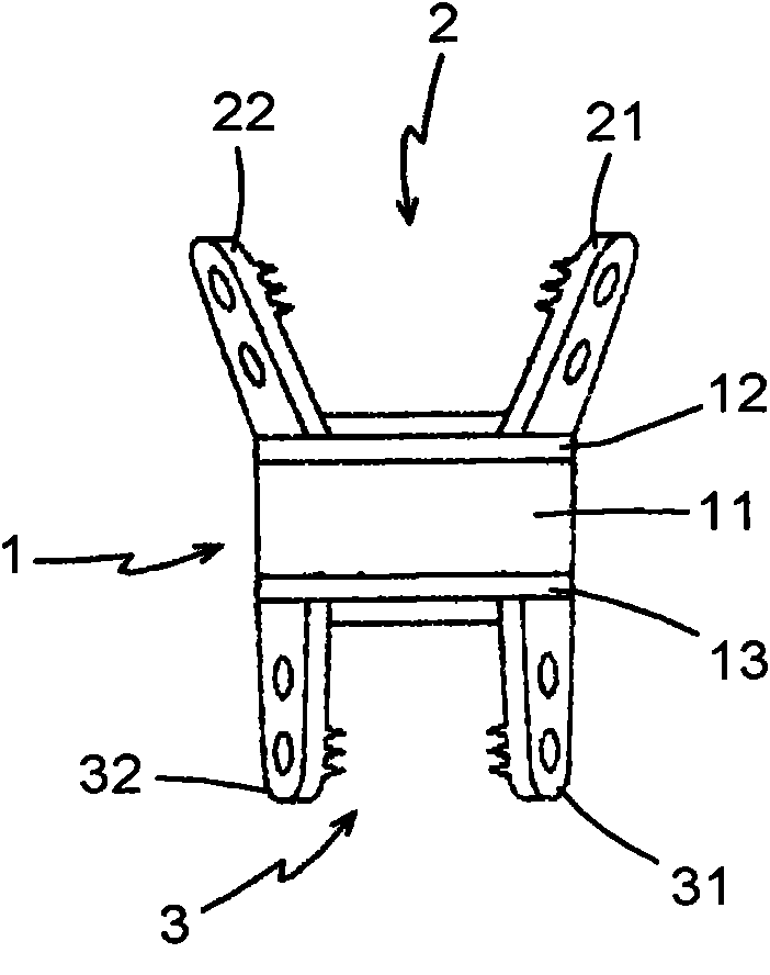 Spacing and stabilizing structure of convex ridges