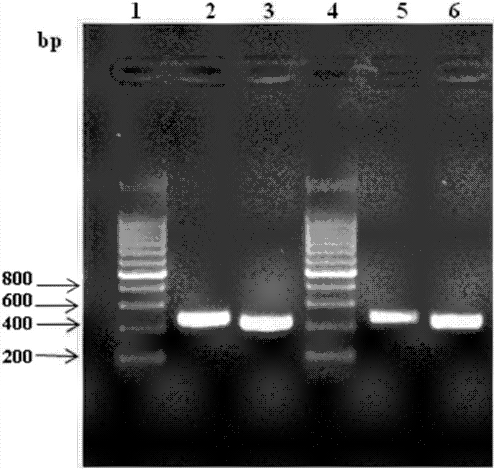 Human c-reactive protein fluorescent quantitative detection test card