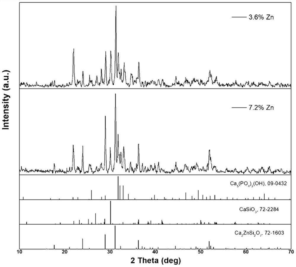 Zinc-doped porous bioactive glass ceramic and preparation method thereof