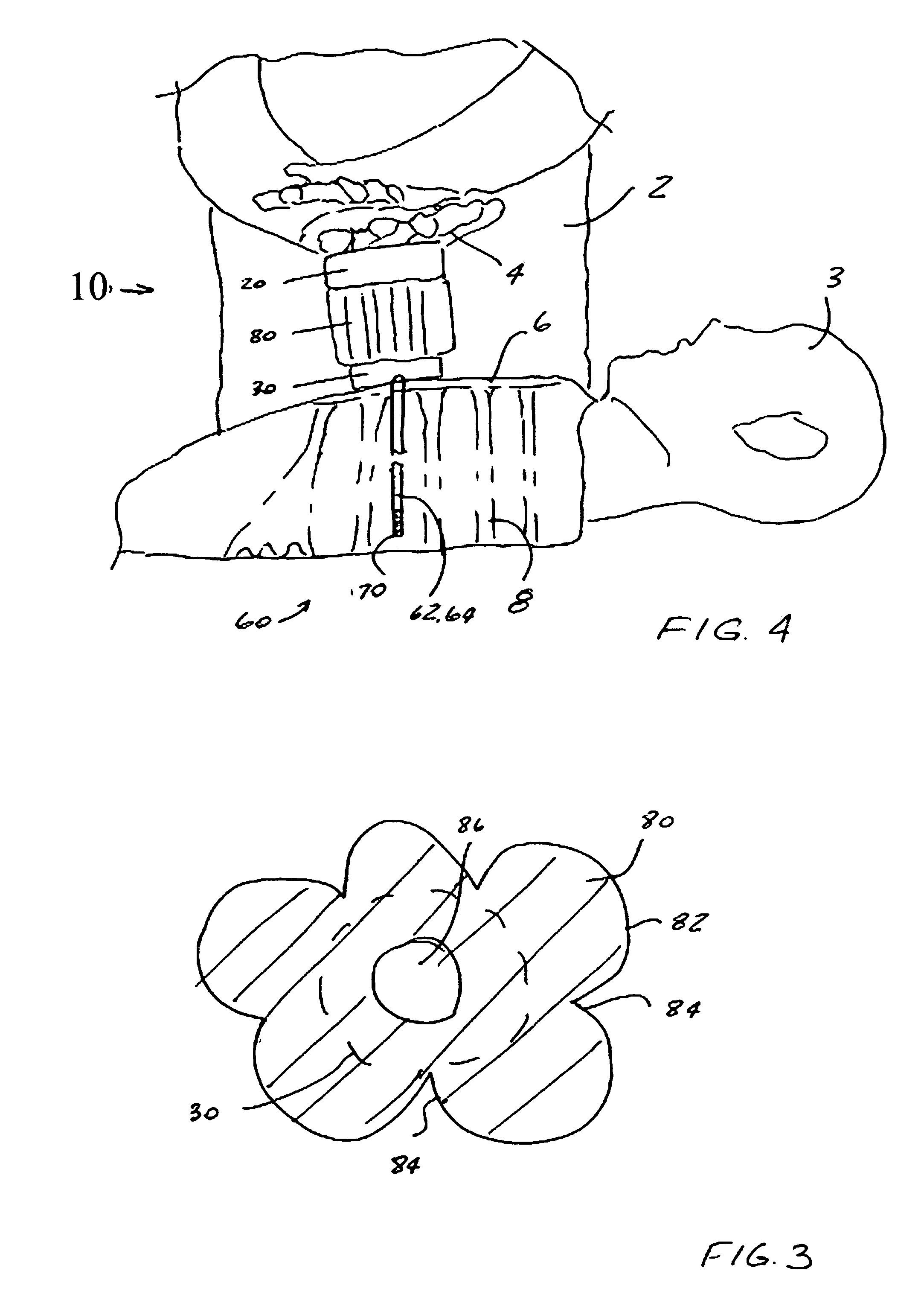 Device and kit for assisting in cardiopulmonary resuscitations