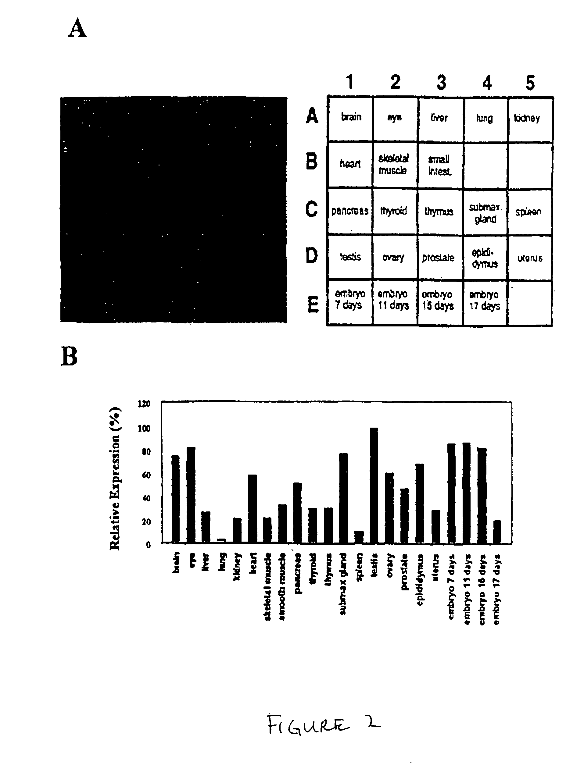 Peripheral-type benzodiazepine receptor associated proteins, cloning, expression and methods of use