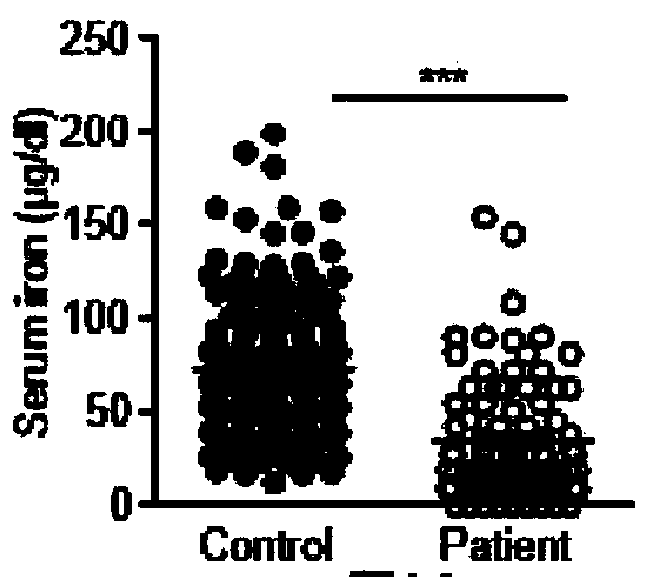 Application of iron removal drug to preparation of H7N9 type bird flu prevention and treatment drugs