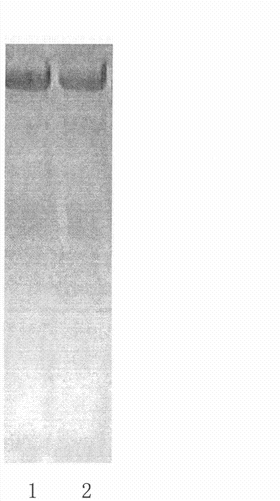 Preparation method of yolk antibody IgY of high-abundance protein in anti-human serum/blood plasma and application thereof